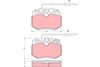 комплект спирачно феродо, дискови спирачки